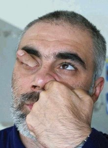 Eyesocket.jpg Eyesocket.jpg